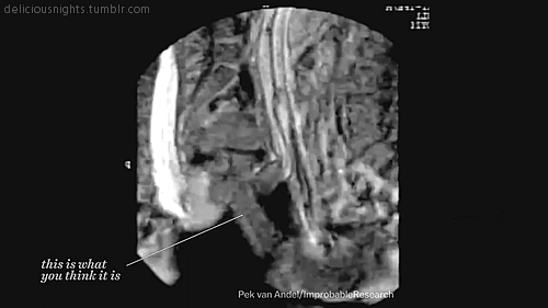 500px x 281px - MRI Archives | Porn Giphy